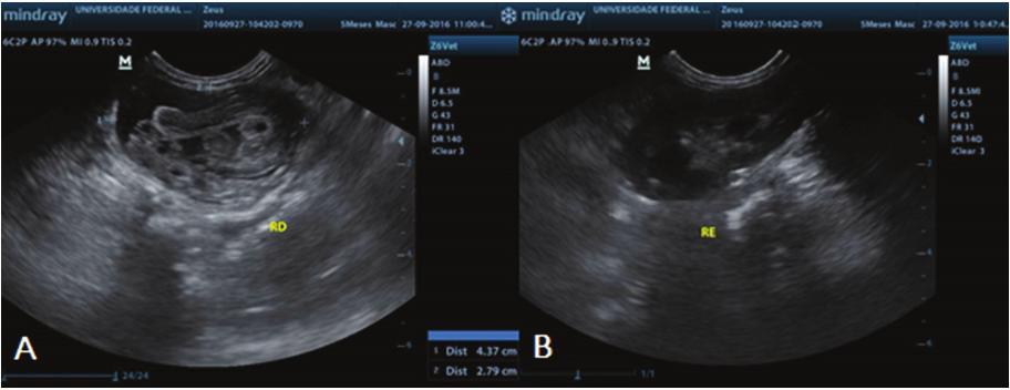 of Dioctophyma renale (Figure 2A). But the left kidney was in normal range (Figure 2B).