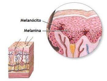 Como surgem as manchas (Melasmas) Pelo mal funcionamento de uma célula chamada MELANÓCITO que prooduz a MELANINA A mancha surge mais facilmente nas partes mais desprotegidas e expostas ao sol com
