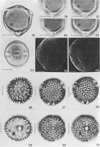 22 C.I. Aguilar-Sierra & T.S. Melhem: Morfologia polínica de Bursereae (Burseraceae) Figuras 18-31.