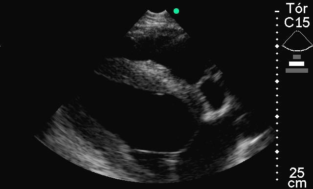 48 Figura 7 Imagem ecocardiográfica do ventrículo esquerdo em Modo B, obtida pela janela