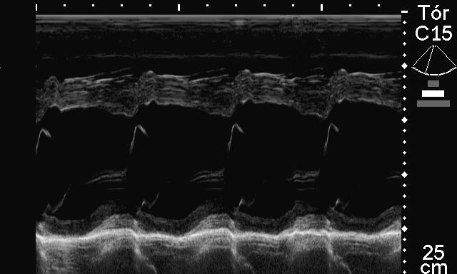 Figura 9 Imagem ecocardiográfica obtida pela janela paraesternal direita, em Modo M do ventrículo esquerdo, em corte transversal de um