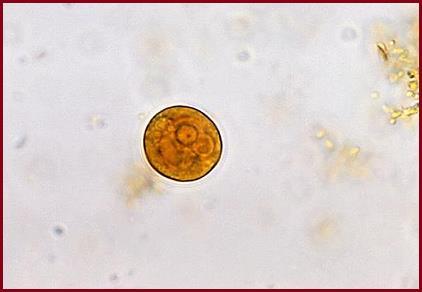 17 (Entamoeba histolytica e Giardia duodenalis), sendo as manifestações clínicas proporcionais à carga parasitária presentes no indivíduo.