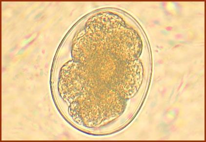 21 3.1.2 Ancilostomíase Figura 3: Ovo e verme adulto de Ancylostoma duodenale e Necator americanus. Fonte: http://monitoria-parasito.blogspot.com.