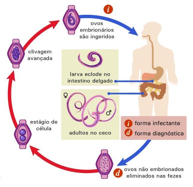 31 Figura 11: Ciclo biológico da Tricuríase no organismo humano. Fonte: http://bioligadosblog.blogspot.com.br/2015/09/ciclos-das-principais-doencas-causadas.html.
