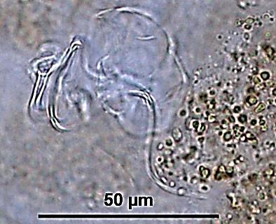 A B 100µm C D 500µm Figura 7. Fotomicrografias de Rhinoxenus sp. n.1: A e B - detalhes do haptor.