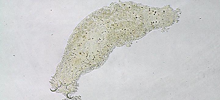 Fotomicrografias em microscópio ótico de Gênero novo A sp. n. 2. Âncoras e barra e ventrais e dorsais; C - Corpo inteiro. Gênero novo A sp. n. 3.