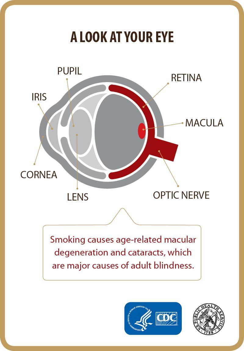 Fumar e risco de Cegueira Fumar aumenta o risco de degenerescência macular e de