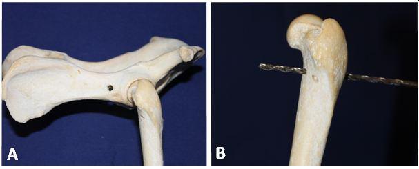 16 Figura 6. Sutura ílio femoral utilizando âncora de titânio e fio de poliéster transado.