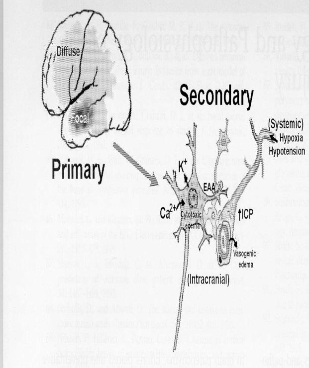 Traumatismo Cranioencefálico 500.000 casos/ano 50 % da mortalidade em trauma 60 % da mortalidade em acidente com veículos automotores.