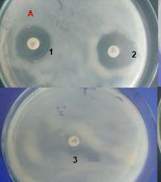 34 Figura 11. Teste de difusão em disco com antibióticos de referência. (A) placa com K.