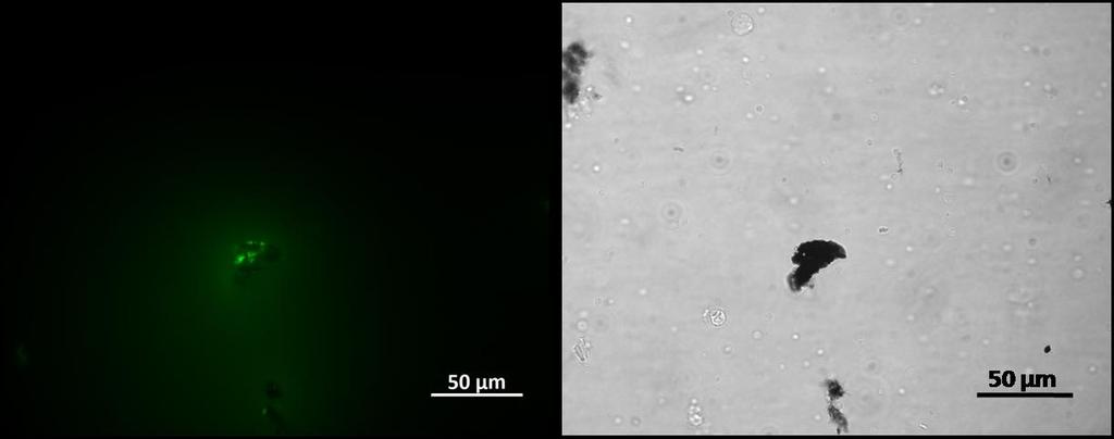 Capítulo IV As amostras separadas magneticamente e por centrifugação foram caracterizadas por microscopia ótica de fluorescência, sendo apresentadas na Figura IV.3 e Figura IV.4 as respetivas imagens.
