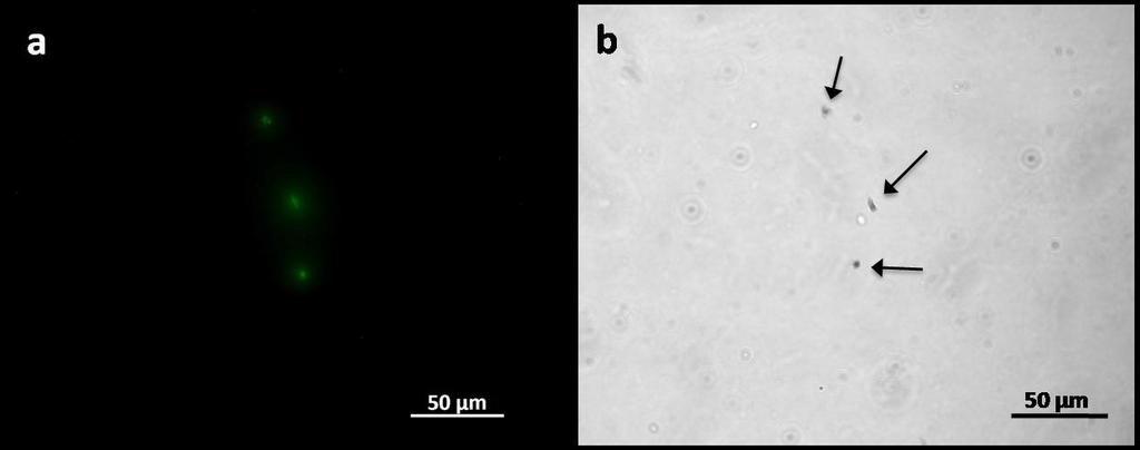 Capítulo IV A Figura IV.4 apresenta imagens de microscopia ótica da amostra obtida após centrifugação. Tendo em conta que esta amostra contém apenas plaquetas (Figura IV.