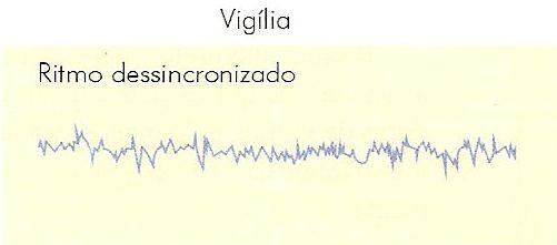 Vigília Neurônios tálamo-corticais são mantidos ligeiramente despolarizados, com o potencial de membrana