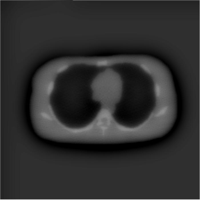 Tabela 1. Resultados de doses em órgãos e tecidos obtidos na simulação de aquisição de imagem CT do tórax do modelo feminino FAX, utilizando o código EGS4.