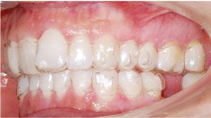 lateral. Fig. 20.   oclusal.