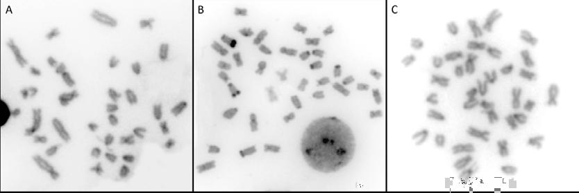 39 Figura 2: Distribuição cromossômica da heterocromatina