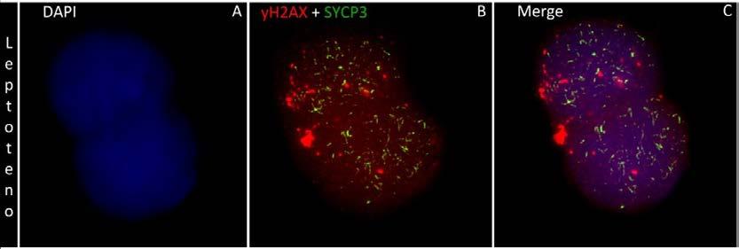 58 Figura 3: Imunodetecção das proteínas SYCP3 do complexo sinaptonêmico (Verde) e da proteína de