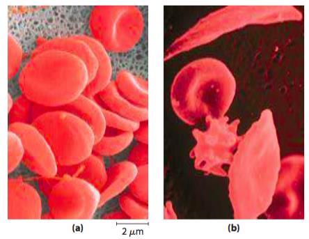 Questão 9 A anemia falciforme é doença humana hereditária. Sabe-se que existem quase 500 variantes genéticas da hemoglobina na população humana; a maioria delas é muito rara.