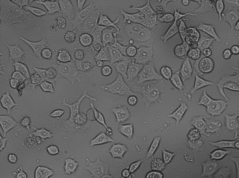 Célula MCF7 (Michigan Cancer Foundation-7) 60 utilizadas para testar a adequação dos microambientes desenvolvidos como plataformas para investigar o desenvolvimento celular. Figura 4.