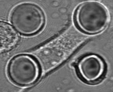 12 - Imagens de microscopia de transmissão e fluorescência