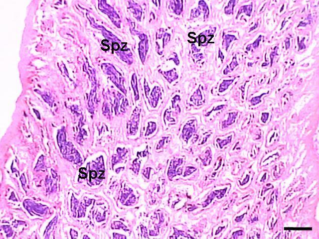 membrana vitelínica; II: folículos pré-vitelogênico