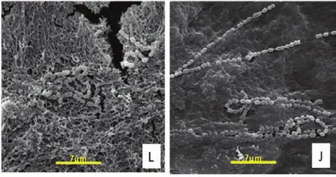 Após a incubação dos implantes em caldo placa in vitro contendo suspensão padronizada do microrganismo a 37º C, 5% de CO 2 por 24 horas, os implantes foram removidos do caldo e foi realizada a fi