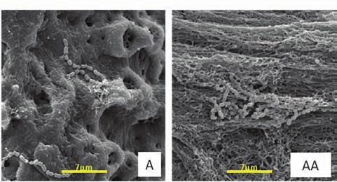 Aderência de microrganismos em implantes dentários de superfície lisa ou tratada Figura 3 - Micrografias representativas da aderência de S.