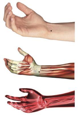 C-6 (YINXI) : FENDA DO YIN Localização: 0,5 cun acima do espaço anterior da articulação da mão, ao punho, ou 0,5 cun acima do ponto C -7, radial ao tendão do músculo flexor ulnar do carpo.
