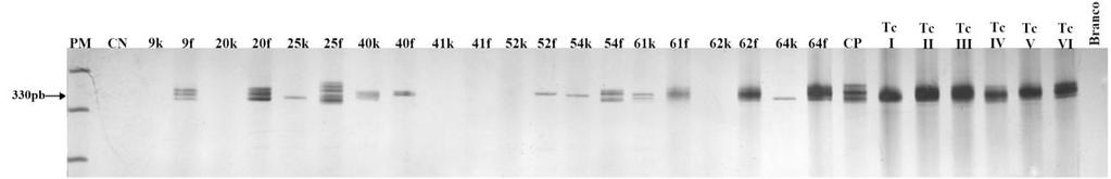 Canaletas 1: PM-peso molecular (Ladder 100pb) e 2: CN-controle negativo (amostra de indivíduo não chagásico); Canaletas 3, 5, 7, 9, 11, 13, 15, 17, 19 e 21 (amostras de DNA extraídas pelo kit