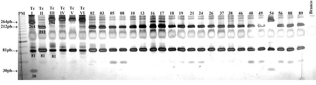 Figura 4 - Gel de poliacrilamida a 6% revelado pela prata representativo da análise dos fragmentos do gene mitocondrial CO II, após a digestão com a enzima Alu I (RFLP - Restriction Fragment Lenght