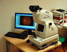 Introdução Capítulo 1 - Introdução A obtenção de imagens da retina de alta qualidade é de grande importância, pois providenciam informação crítica que permite diagnosticar patologias oculares tais