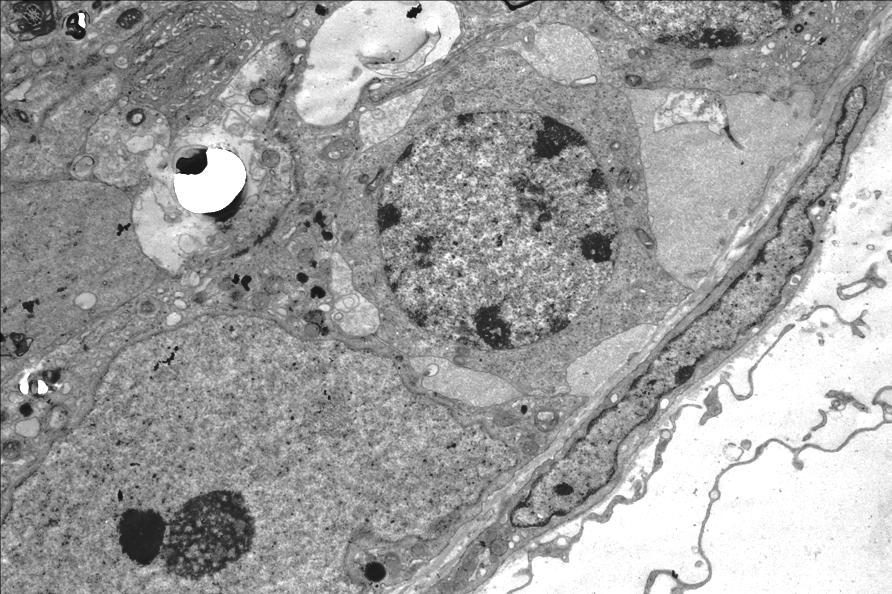 E S M T. Montanari & Heidi Dolder, UNICAMP Eletromicrografia de segmento de testículo de camundongo, mostrando a espermatogônia (E), a célula de Sertoli (S) e a célula mioide peritubular (M).