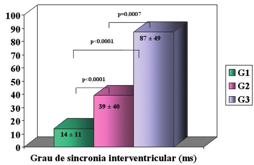 Tabela 2 - Medidas da duração do QRS ao ECG e da função ventricular direita e esquerda avaliadas através da VR Dados (média ± DP) G1 G2 G3 QRS (ms) 85 ± 9 99 ± 11 160 ± 24 FEVD (%) 46 ± 4 38 ± 9* 37