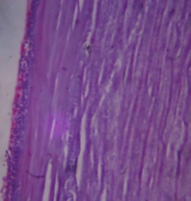 Depósitos de cálcio na córnea: estudo histopatológico 291 finidas com colorações que variaram de basofílica a levemente eosinofílica.