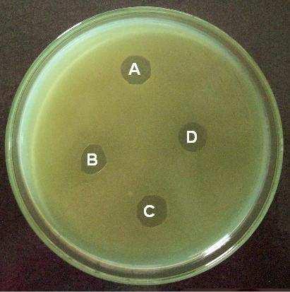 (a) (b) (c) Figura 5 Inibição de Pseudomonas aeruginosa (a), Salmonella cholerasuis (b) e Listeria innocua (c) por filmes obtidos dos diferentes tratamentos: tratamento com 0% - controle (A);
