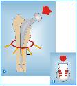 Conicidade: Maior estabilidade axial, permitindo melhor transmissão dos esforços para o osso Canelada: Maior estabilidade rotacional Menor Stress Shielding: Remodelação óssea adaptativa por menor