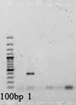 Figura 6 - Produtos de amplificação de DNA por PCR com primers específicos, separados em gel de agarose a 2%. 1 - Amostra BTR2C_20 amplificada com primers específico de D. hanseni.
