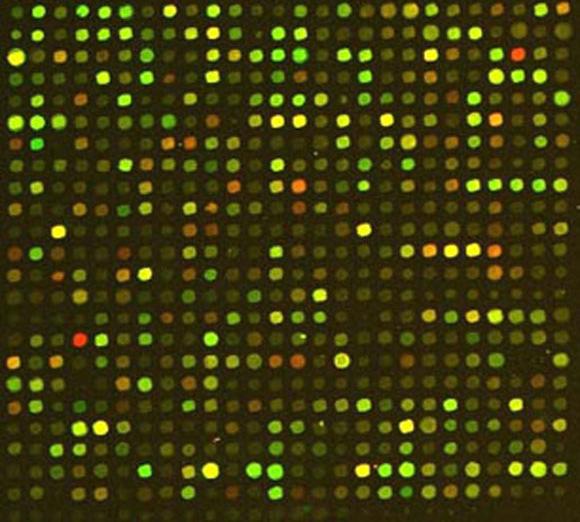 Materiais e métodos Expressão gênica: Microarray para 3598 genes.