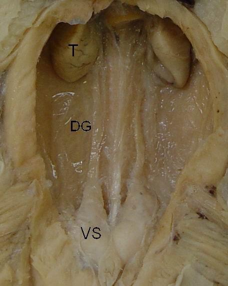 Figura 2.5; Sistema reprodutivo de macho Narcine brasiliensis.