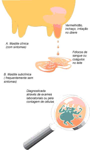 1. Mastite Clínica Fonte: www.