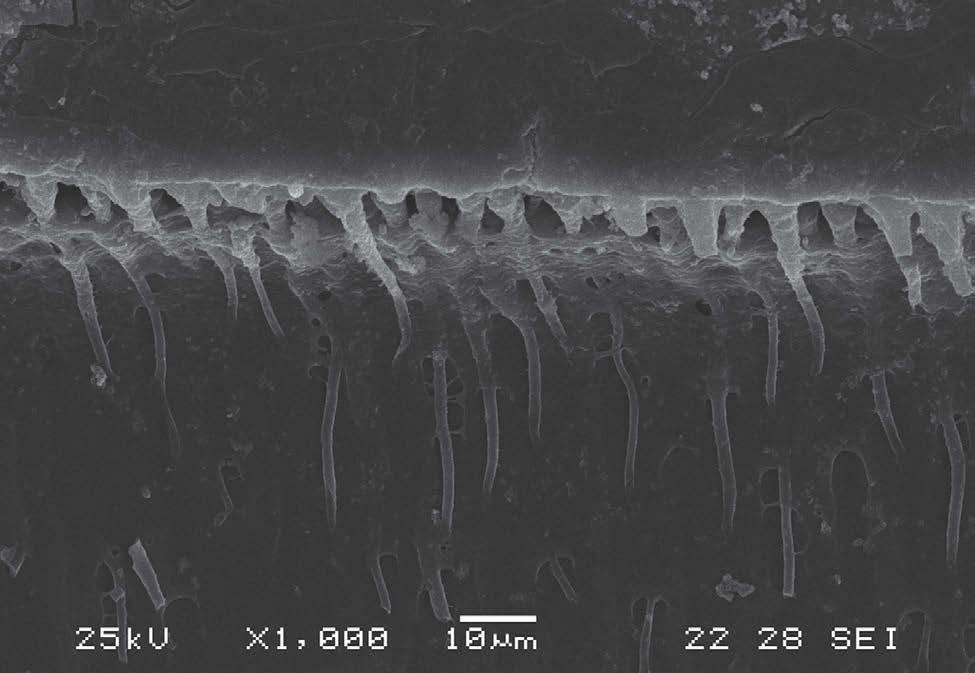 Zolet RRS, Bridi EC, França FMG, Amaral FLB, Turssi CP, Basting RT a superfície da dentina deve ser mantida com umidade, mas podendo esse substrato se apresentar ligeiramente mais seco.