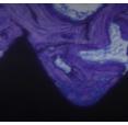 Average SA from 0.5 to 2.0 microns. RA médio de 1,56 microns.