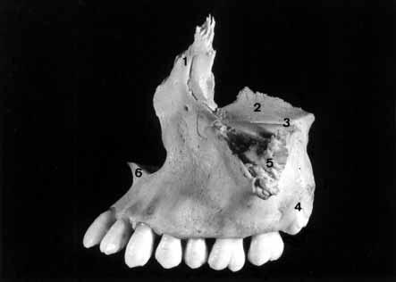 29 Figura 2-9 Vista lateral de uma maxila separada do crânio.