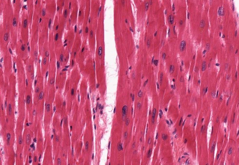 Questão 15 Identifique o tipo muscular citado e as estruturas indicadas nas setas azul, amarela e preta.