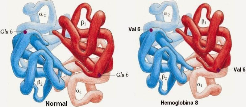 hemácia e então, originando a hemoglobina S (Figura 1). Isso ocasiona uma perda do seu formato discóide tornando-a alongada e com formato de foice, daí o nome hemácia falcizada.
