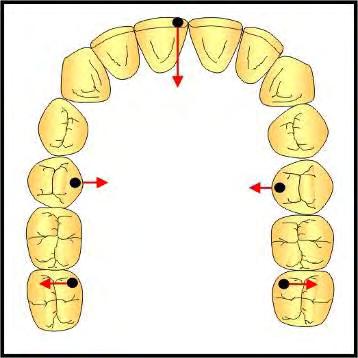 5-Resultados 130 FIGURA 36 Padrão presumido de alterações dos dentes em função da análise dos segmentos para o