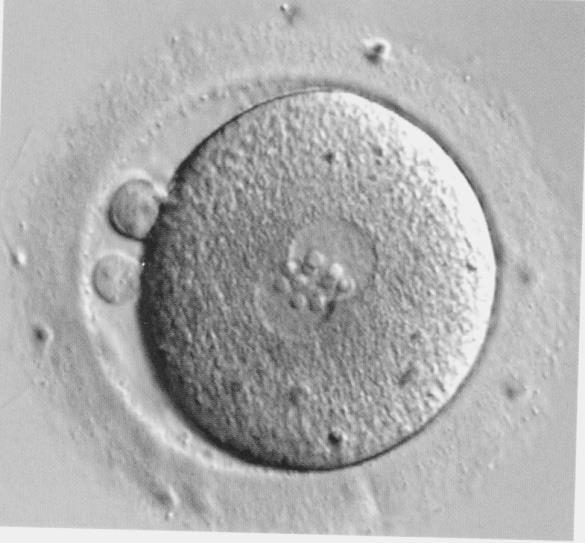 1 INTRODUÇÃO Figura 5 - Oócito fertilizado ( Presença de dois pró-núcleos e dois corpúsculos polares) Fonte: VEECK,L.