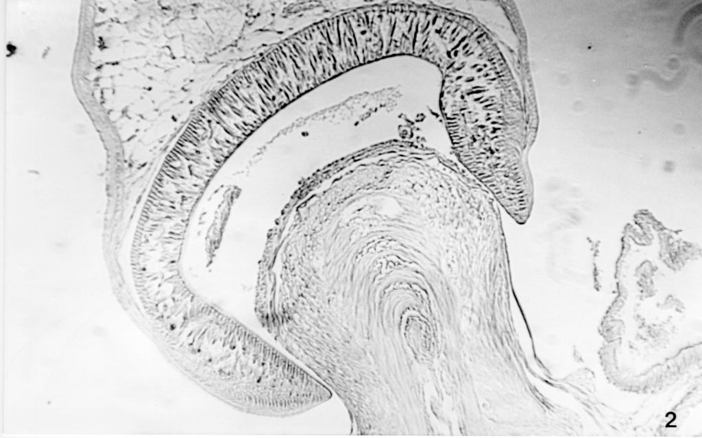 476 Pavanelli et al. No interior da ventosa, a camada epitelial encontra-se intensamente modificada, perdendo a sua estrutura normal.