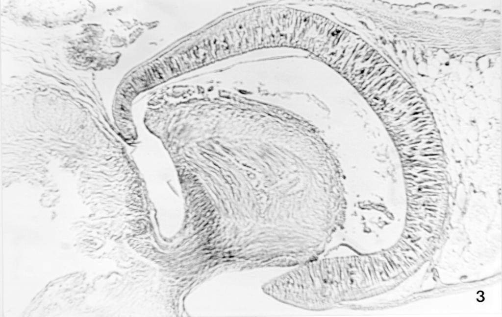 Histopatologia da parasitose de Microrchis oligovitellum 477 praticamente desaparecidos e a quantidade de restos celulares e material amorfo-indiferenciado é maior (Figura 3). Figura 3.