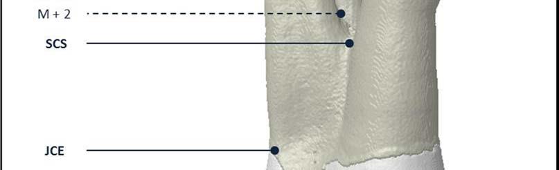 correspondente à metade da extensão do sulco radicular (M), 2 mm acima da secção central (M + 2), 1 mm acima da secção central (M + 1), na secção central (M), 2 mm